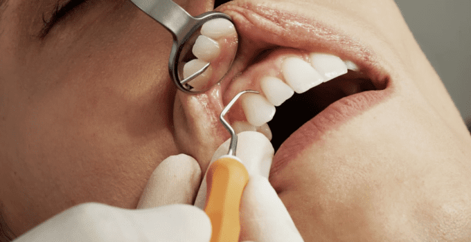 Dental arthritis